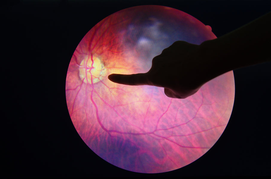 Diabetic Eye Disease Month