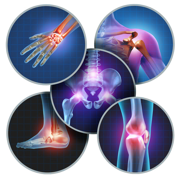 Understanding Arthritis Management